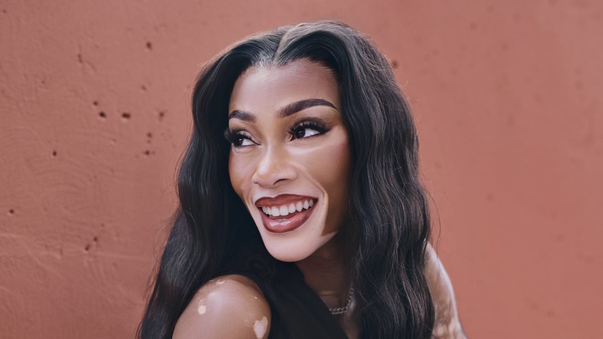 Winnie Harlow Partners With Incyte To Empower The Vitiligo Community