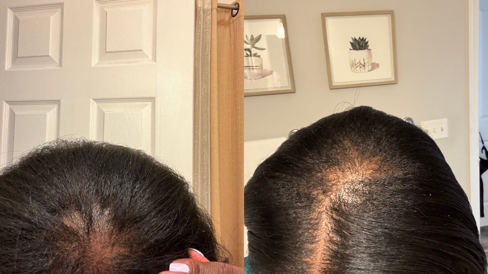 I'm A Black Woman With Thinning Hair—Here's What's Bringing My Strands Back To Life