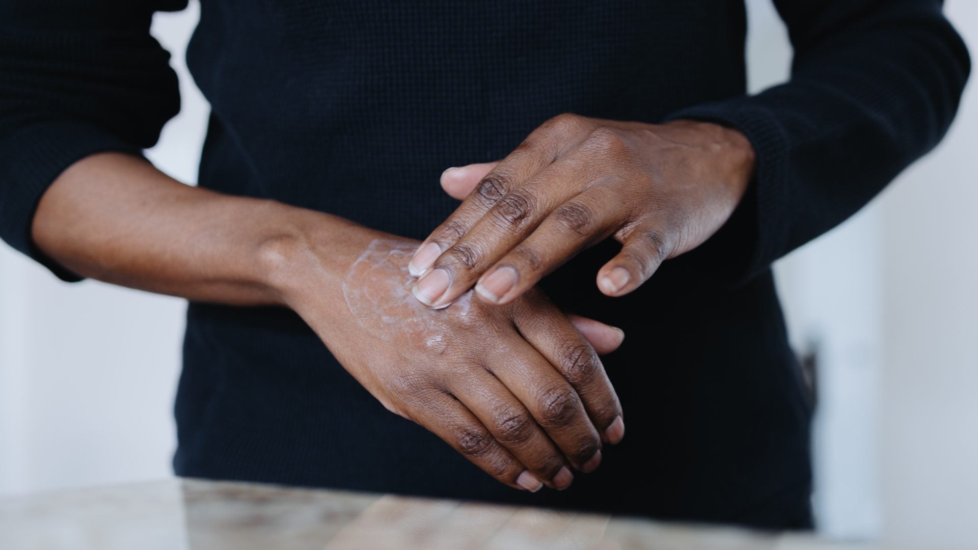 Your Hands Deserve A Skincare Routine Too: How To Fade Stubborn Dark Spots Fast