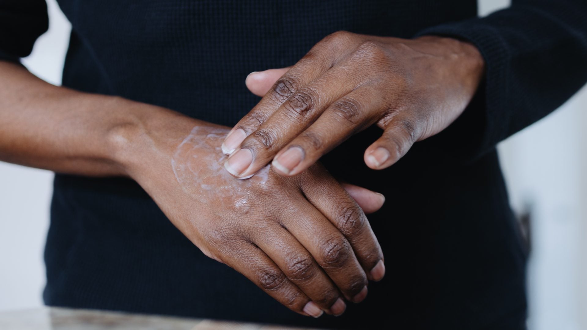 Your Hands Deserve A Skincare Routine Too: How To Fade Stubborn Dark Spots Fast
